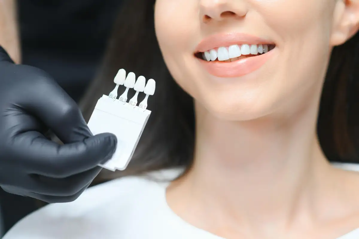 Zirconium Crowns or E-max Veneers? Choosing the Right Material