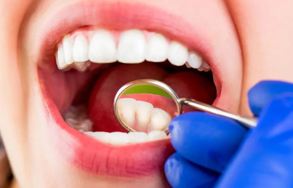 Focus Dental Gümbet Dentist